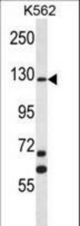 MCF2 Antibody western blot of K562 cell line lysates (35 ug/lane). The MCF2 antibody detected the MCF2 protein (arrow).