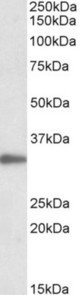 PCNA antibody (0.05 ug/ml) staining of Jurkat lysate (35 ug protein in RIPA buffer). Primary incubation was 1 hour. Detected by chemiluminescence.