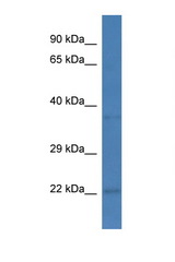 PCNP antibody LS-C135442 Western blot of Mouse Spleen lysate. Antibody concentration 1 ug/ml.