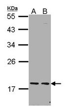 Sample (30 ug of whole cell lysate). A: H1299, B: Hela. 12% SDS PAGE. PCNP antibody diluted at 1:1000.