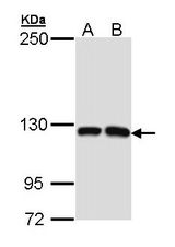 Sample (30 ug of whole cell lysate). A: Molt-4 , B: Raji. 5% SDS PAGE. MCF2L / DBS antibody diluted at 1:1000.