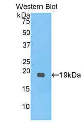 Western blot of recombinant PCOLCE.