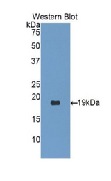 Western blot of recombinant PCOLCE2.