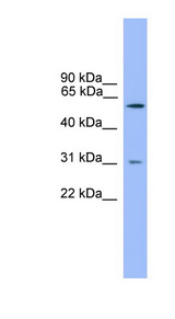 PCSK2 antibody LS-C135548 Western blot of HeLa lysate.