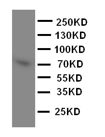 WB of PCSK2 antibody. WB: PANC Cell Lysate.
