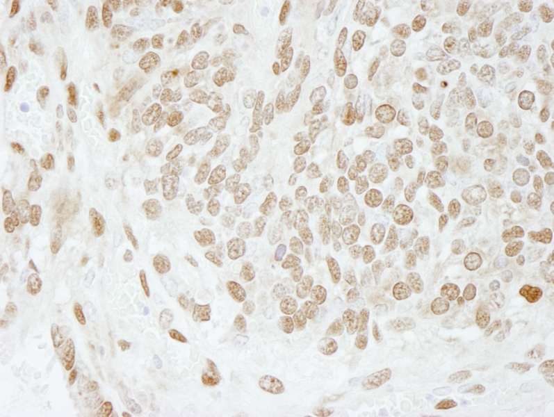 Detection of Mouse PC4 by Immunohistochemistry. Sample: FFPE section of mouse teratoma. Antibody: Affinity purified rabbit anti-PC4 used at a dilution of 1:250.