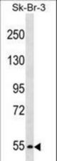 PCSK4 Antibody western blot of SK-BR-3 cell line lysates (35 ug/lane). The PCSK4 antibody detected the PCSK4 protein (arrow).