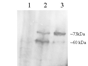 Antibody staining (0.2 ug/ml) of McA cell lysates: untransfected (1), transfected with wild type human pcsk9 (2), transfected with S127R human pcsk9 (3).