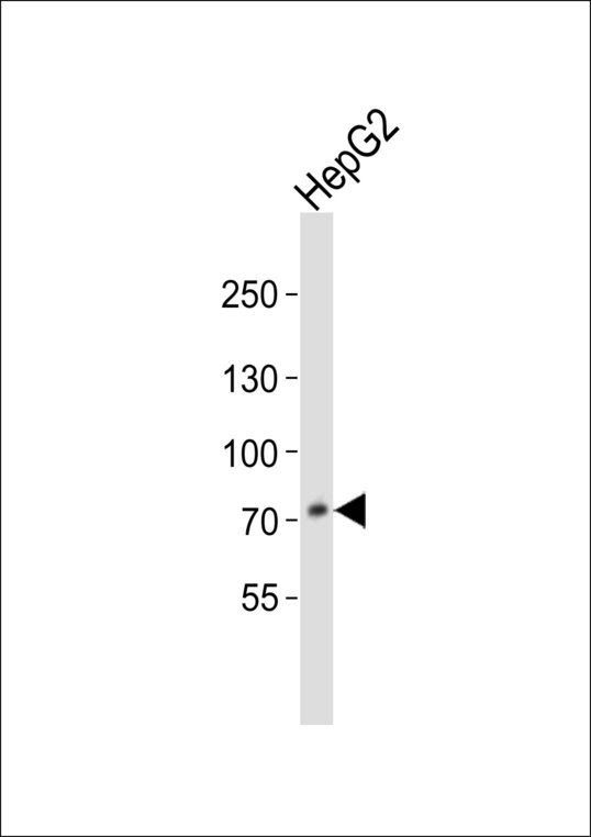 Western blot of lysate from HepG2 cell line, using PCSK9 Antibody. Antibody was diluted at 1:1000. A goat anti-rabbit IgG H&L (HRP) at 1:10000 dilution was used as the secondary antibody. Lysate at 20ug.