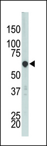 The anti-PCTK3 antibody is used in Western blot to detect PCTK3 in HL-60 cell lysate.