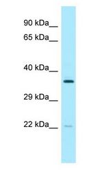 PCTP antibody Western Blot of 721_B.