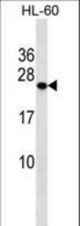 PCTP Antibody western blot of HL-60 cell line lysates (35 ug/lane). The PCTP antibody detected the PCTP protein (arrow).