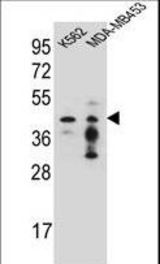 PCYT1A Antibody western blot of K562,MDA-MB453 cell line lysates (35 ug/lane). The PCYT1A antibody detected the PCYT1A protein (arrow).