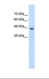 Jurkat cell lysate. Antibody concentration: 2.5 ug/ml. Gel concentration: 12%.