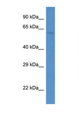 PAF1 antibody LS-C145310 Western blot of Jurkat Cell lysate. Antibody concentration 1 ug/ml.