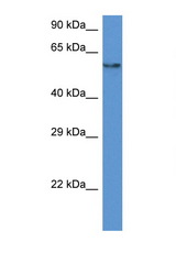PAF1 antibody LS-C145311 Western blot of HepG2 Cell lysate. Antibody concentration 1 ug/ml.