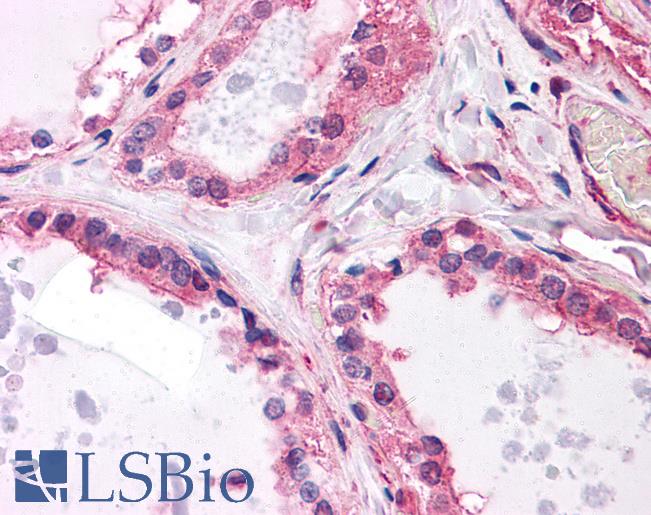 Anti-MCF2L antibody IHC of human thyroid. Immunohistochemistry of formalin-fixed, paraffin-embedded tissue after heat-induced antigen retrieval. Antibody LS-B4519 concentration 5 ug/ml.