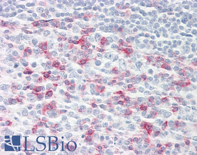 Anti-CD279 / PD-1 antibody IHC of human tonsil. Immunohistochemistry of formalin-fixed, paraffin-embedded tissue after heat-induced antigen retrieval. Antibody LS-B7883 dilution 20 ug/ml.