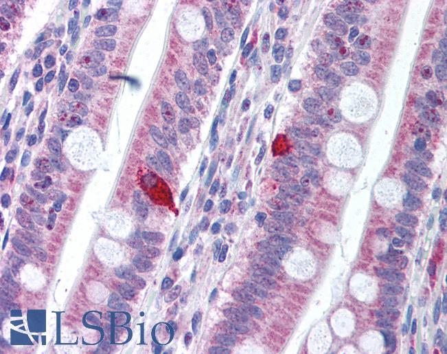 Anti-PD1 antibody IHC of human small intestine. Immunohistochemistry of formalin-fixed, paraffin-embedded tissue after heat-induced antigen retrieval. Antibody LS-B1387 concentration 10 ug/ml.