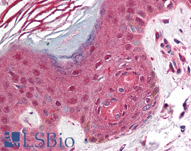 Anti-PD1 antibody IHC of human skin. Immunohistochemistry of formalin-fixed, paraffin-embedded tissue after heat-induced antigen retrieval. Antibody LS-B540 concentration 5 ug/ml.