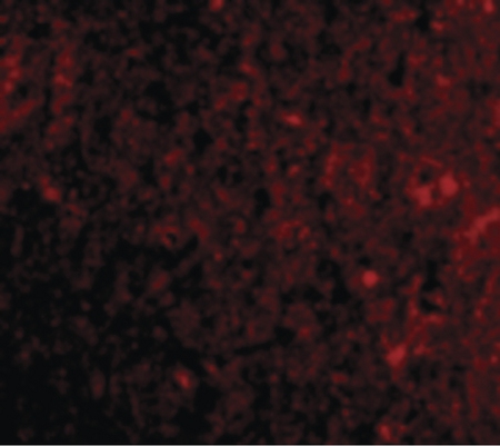 Immunofluorescence of PD-1 in Human Brain cells with PD-1 antibody at 20 ug/ml.