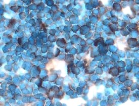 PD-L2 in Mouse Thymus. PD-L2 was detected in perfusion fixed frozen sections of mouse thymus using 15 ug/ml Goat Anti-Mouse PD-L2 Antigen Affinity-purified Polyclonal Antibody overnight at 4°C. Tissue was stained with Anti-Goat HRP-DAB (brown) and counterstained with hematoxylin (blue).