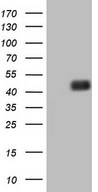 HEK293T cells were transfected with the pCMV6-ENTRY control (Left lane) or pCMV6-ENTRY PDCD1LG2 (Right lane) cDNA for 48 hrs and lysed. Equivalent amounts of cell lysates (5 ug per lane) were separated by SDS-PAGE and immunoblotted with anti-PDCD1LG2.