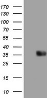 HEK293T cells were transfected with the pCMV6-ENTRY control (Left lane) or pCMV6-ENTRY PDCD1LG2 (Right lane) cDNA for 48 hrs and lysed. Equivalent amounts of cell lysates (5 ug per lane) were separated by SDS-PAGE and immunoblotted with anti-PDCD1LG2.