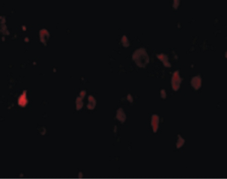 Immunofluorescence of PDL-2 in Mouse Brain cells with PDL-2 antibody at 20 ug/ml.