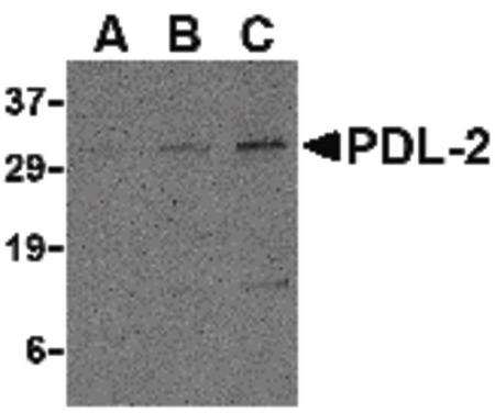 Western blot of PDL-2 in Raji cell lysate with PDL-2 antibody at (A) 0.5, (B) 1 and (C) 2 ug/ml.