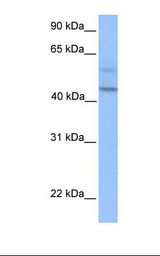 Hela cell lysate. Antibody concentration: 1.0 ug/ml. Gel concentration: 12%.