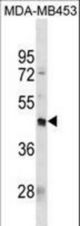 PDCD2L Antibody western blot of MDA-MB453 cell line lysates (35 ug/lane). The PDCD2L antibody detected the PDCD2L protein (arrow).