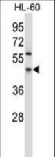 PDCD4 Antibody western blot of HL-60 cell line lysates (35 ug/lane). The PDCD4 antibody detected the PDCD4 protein (arrow).