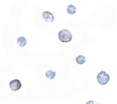 Immunocytochemistry of PDCD5 in Jurkat cells with PDCD5 antibody at 5 ug/ml.