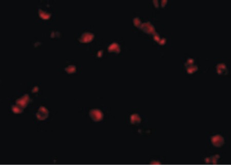 Immunofluorescence of PDCD5 in Jurkat cells with PDCD5 antibody at 10 ug/ml.