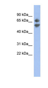 PDCD7 antibody LS-C112256 Western blot of NCI-H226 cell lysate.