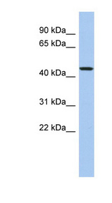 PDCD7 antibody LS-C112255 Western blot of MCF7 cell lysate.