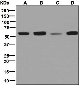 Western blot analysis on (A) HeLa, (B) Jurkat, (C) MCF-7, and (D) Caco-2 cell lysates using anti-PDCD7 antibody.