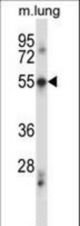 PDCD7 Antibody western blot of mouse lung tissue lysates (35 ug/lane). The PDCD7 antibody detected the PDCD7 protein (arrow).