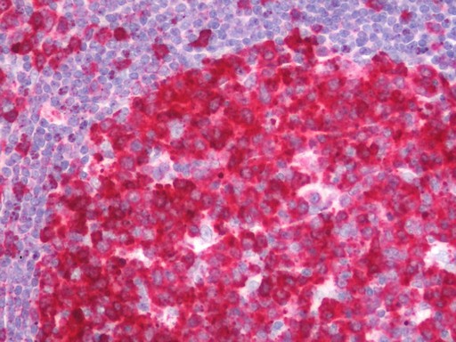 Human Tonsil: Formalin-Fixed, Paraffin-Embedded (FFPE) 