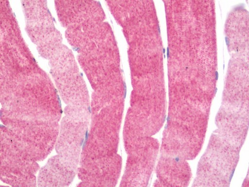 Human Skeletal Muscle: Formalin-Fixed, Paraffin-Embedded (FFPE)