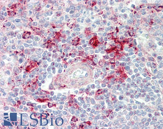 Anti-MCF2L / DBS antibody IHC staining of human spleen. Immunohistochemistry of formalin-fixed, paraffin-embedded tissue after heat-induced antigen retrieval. Antibody LS-B9783 dilution 1:100.