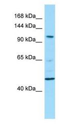 PDE11A antibody Western Blot of U937.