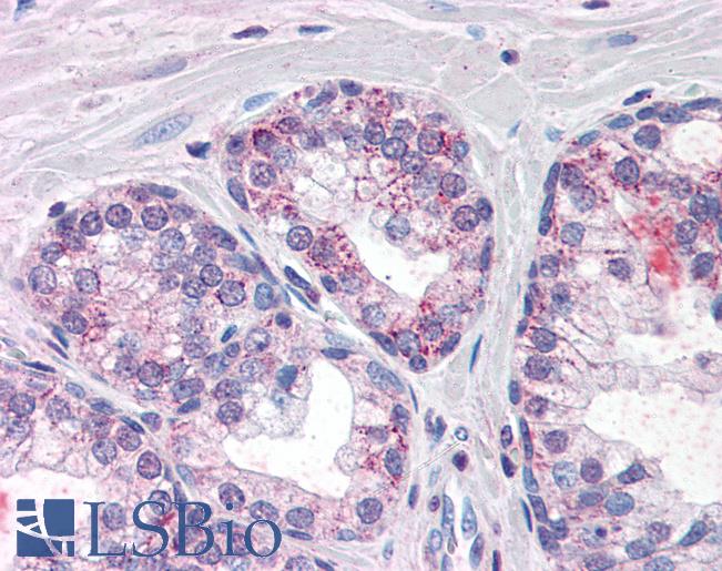 Anti-PDE11A antibody IHC of human prostate. Immunohistochemistry of formalin-fixed, paraffin-embedded tissue after heat-induced antigen retrieval. Antibody LS-B2676 concentration 10 ug/ml.