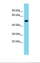 Western blot of Human Ovary Tumor. PDE12 antibody dilution 1.0 ug/ml.