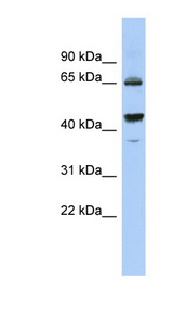 PDE12 antibody LS-C111507 Western blot of OVCAR-3 cell lysate.