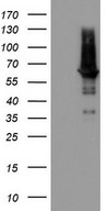 HEK293T cells were transfected with the pCMV6-ENTRY control (Left lane) or pCMV6-ENTRY PDE1A (Right lane) cDNA for 48 hrs and lysed. Equivalent amounts of cell lysates (5 ug per lane) were separated by SDS-PAGE and immunoblotted with anti-PDE1A.