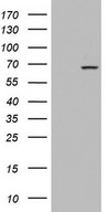 HEK293T cells were transfected with the pCMV6-ENTRY control (Left lane) or pCMV6-ENTRY PDE1A (Right lane) cDNA for 48 hrs and lysed. Equivalent amounts of cell lysates (5 ug per lane) were separated by SDS-PAGE and immunoblotted with anti-PDE1A.