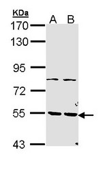 Sample (30 ug of whole cell lysate). A: H1299, B: Hela. 7.5% SDS PAGE. PDE1A antibody diluted at 1:1000.