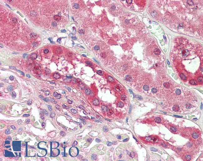 Anti-PDE1A antibody IHC staining of human kidney. Immunohistochemistry of formalin-fixed, paraffin-embedded tissue after heat-induced antigen retrieval.